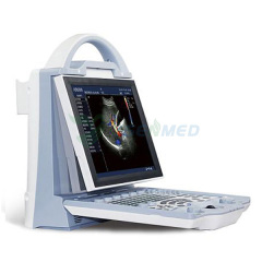 YSB-DU12 Best Price Portable Color Doppler Ultrasound Machine