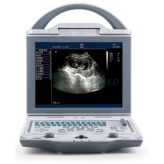 YSB5600 Portable Black And White Ultrasound Machine