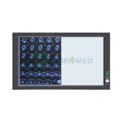 LED Negatoscope / LED Film Viewer / LED Film Illuminator YSX-GPD02