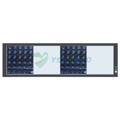 LED Negatoscope / LED Film Viewer / LED Film Illuminator YSX-GPD04