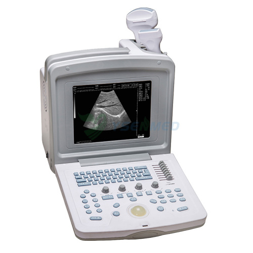 YSB-180 China Portable B/W Ultrasound Machine