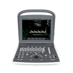 CHISON ECO2 Portable B/W ultrasound scanner