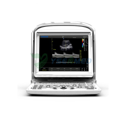 CHISON ECO1 Portable B/W ultrasound scanner