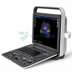 Laptop Color Doppler Ultrasound Machine SonoScape S8Exp