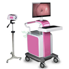 Gynecology Video Colposcope YSSW3303