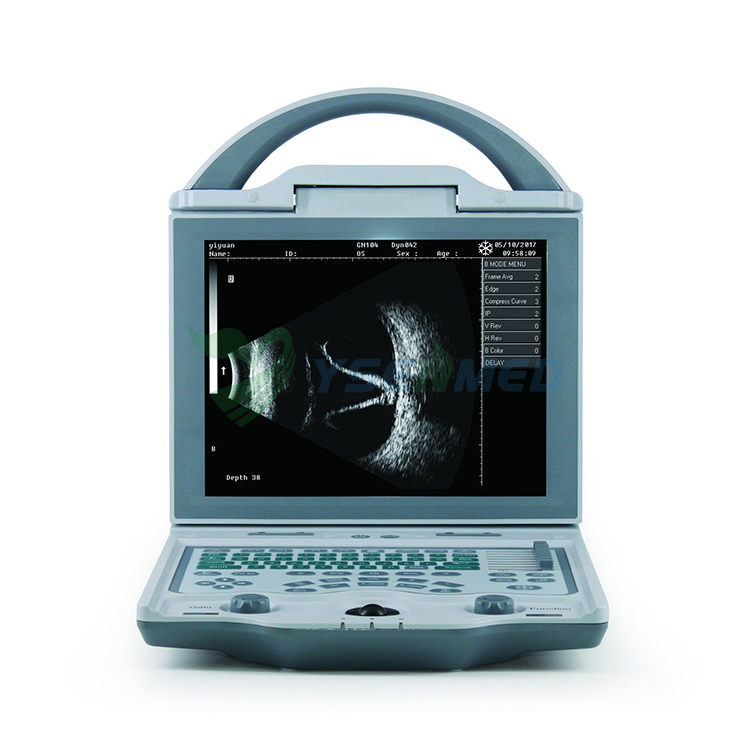 Portable Ophthalmic A/B Scan Optical Ultrasound YSODU5,Ophthalmic Scanners