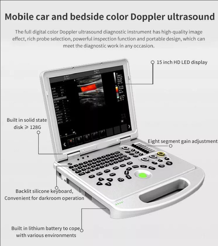 Scanner à ultrasons couleur portable à vente chaude YSB-L5PRO