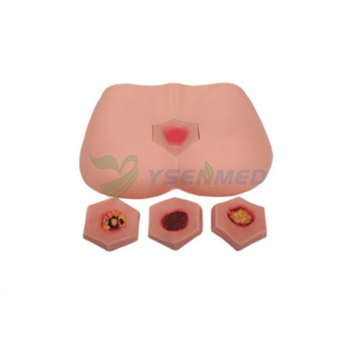 Stage of pressure ulcers nursing model YSBIX-H10B
