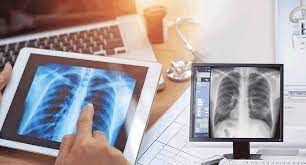 How X-ray Flat Panel Detectors are Revolutionizing Medical Imaging