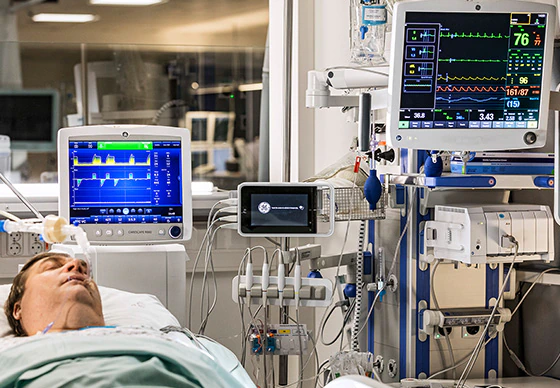 Why Patient Monitors are Essential in Modern Healthcare