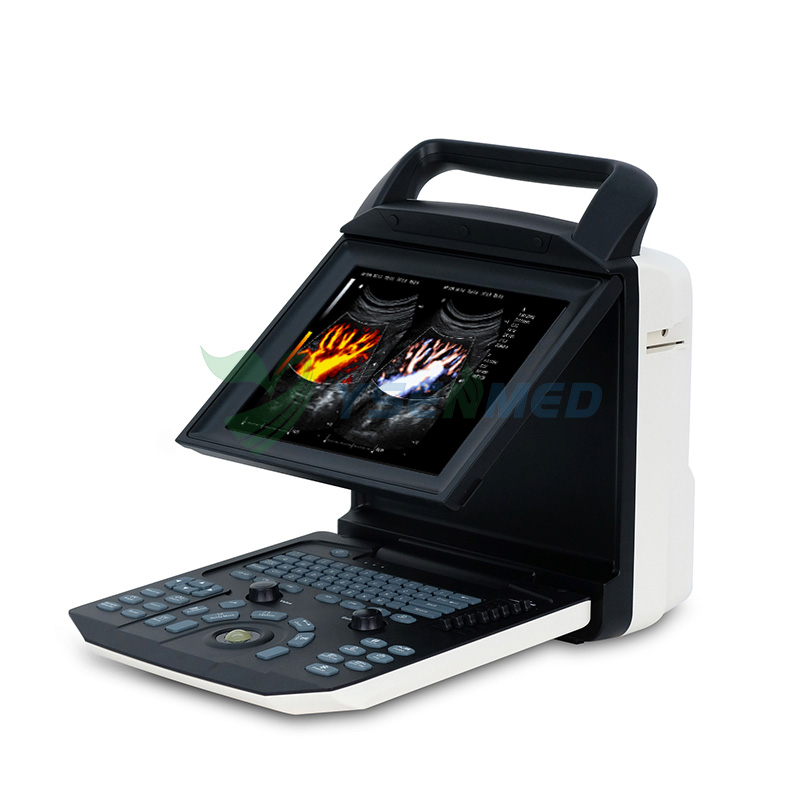 Thyroid scanning in color mode with YSENMED YSB-M5 portable color doppler ultrasound system.