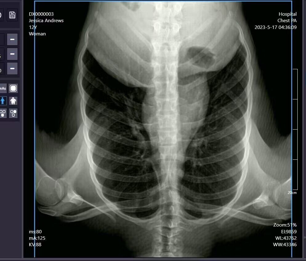 Our Doctor Client From Zimbabwe Is Very Happy With The Image Quality Of The YSENMED YSX500D 50kW Medical Digital X-Ray System