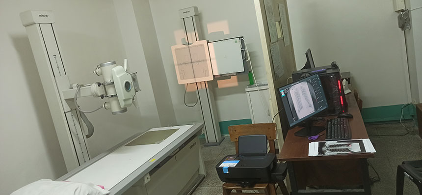Philippine Customer Share His Analog X-Ray System Using Dr Flat Panel Detector YSFPD4343Z Digitized
