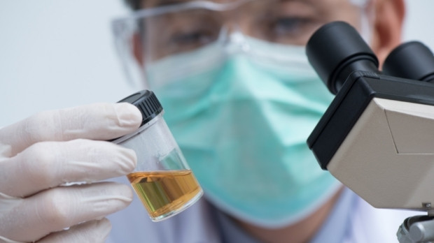 The Importance of Urine Analysis in Early Disease Detection