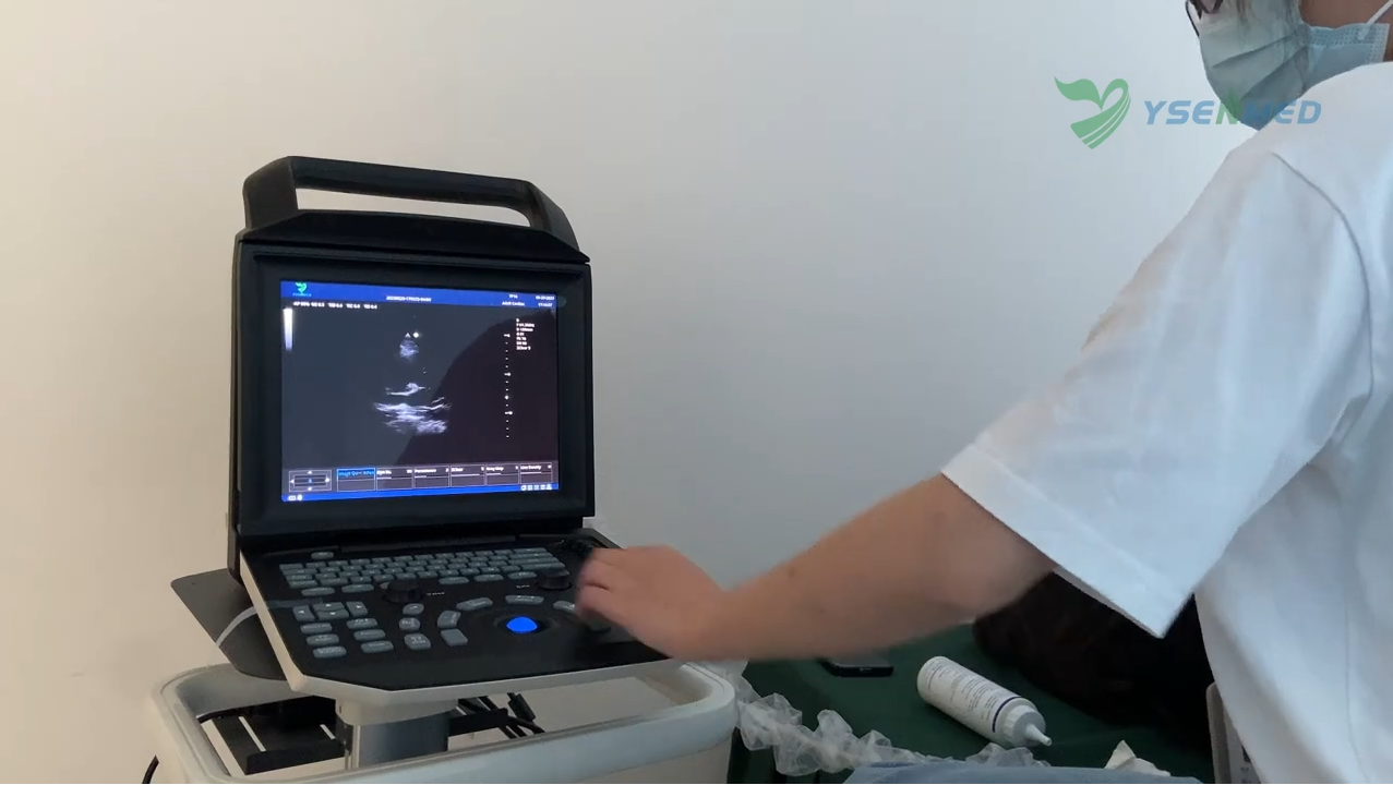 Ultrasound Cardiac Scanning By YSENMED Portable Color Ultrasound System YSB-M5
