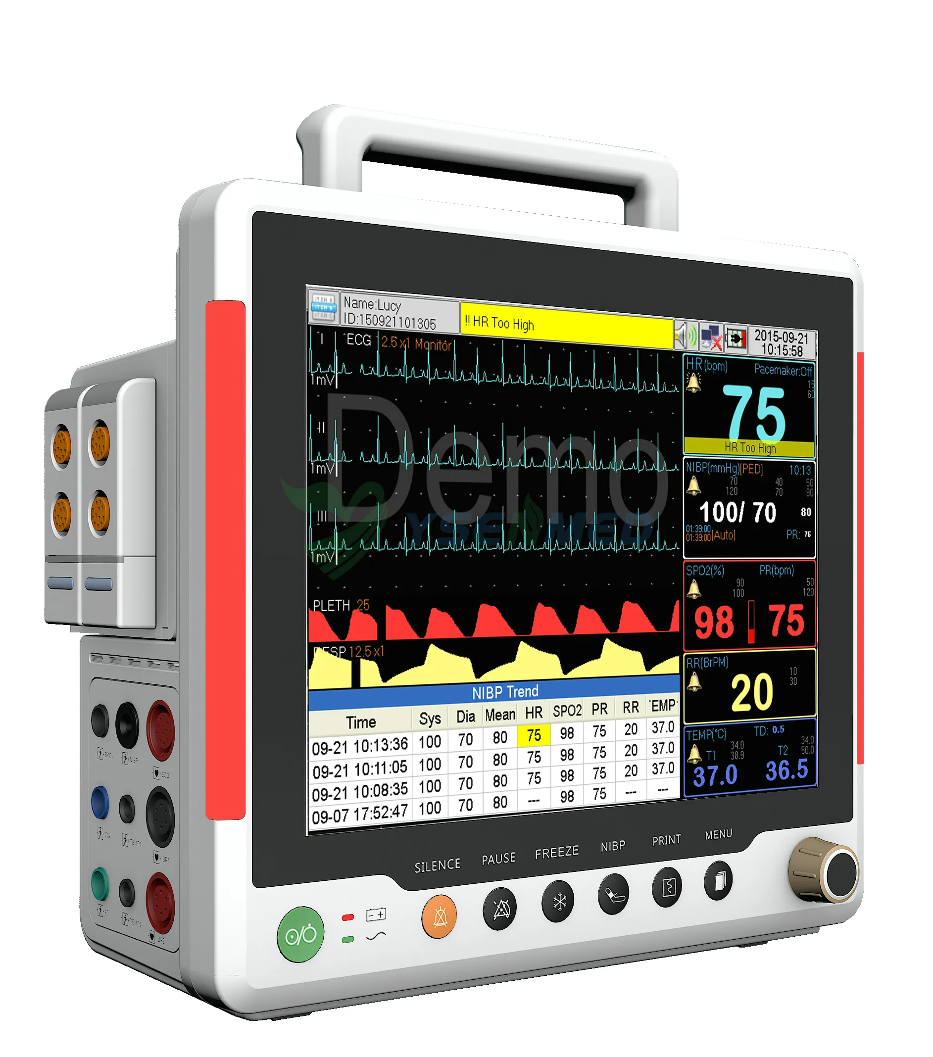 YSENMED YSF8 multi-parameter patient monitor in pre-delivery aging test.