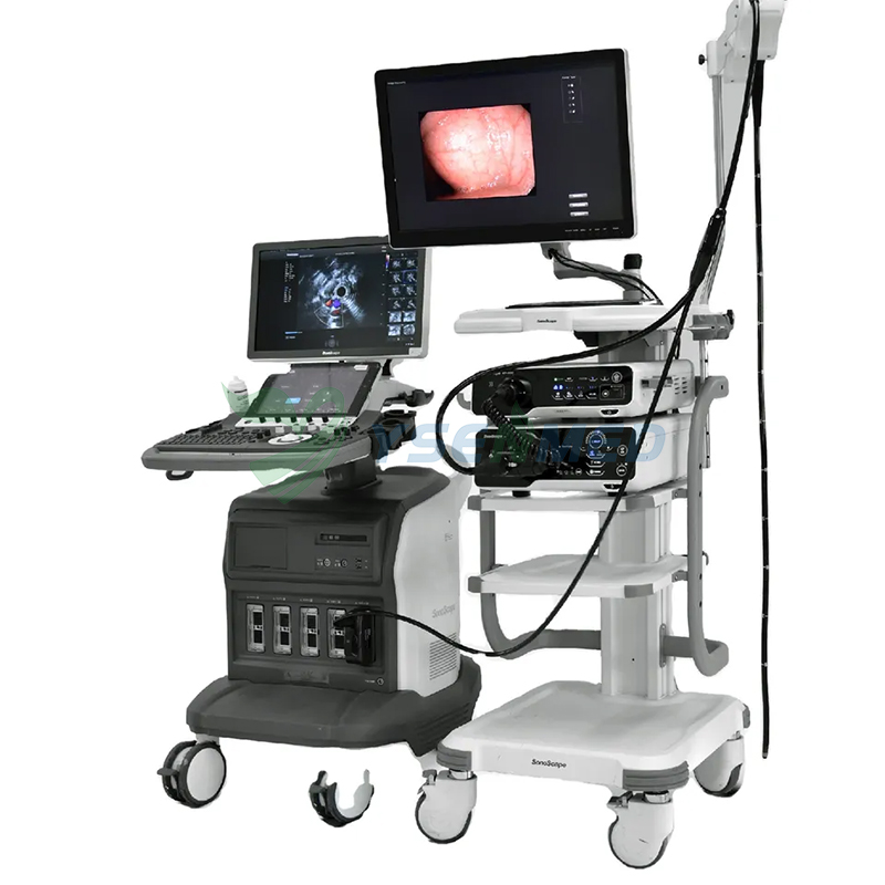 Endoscopia de alta definición: transformando el futuro de las imágenes médicas