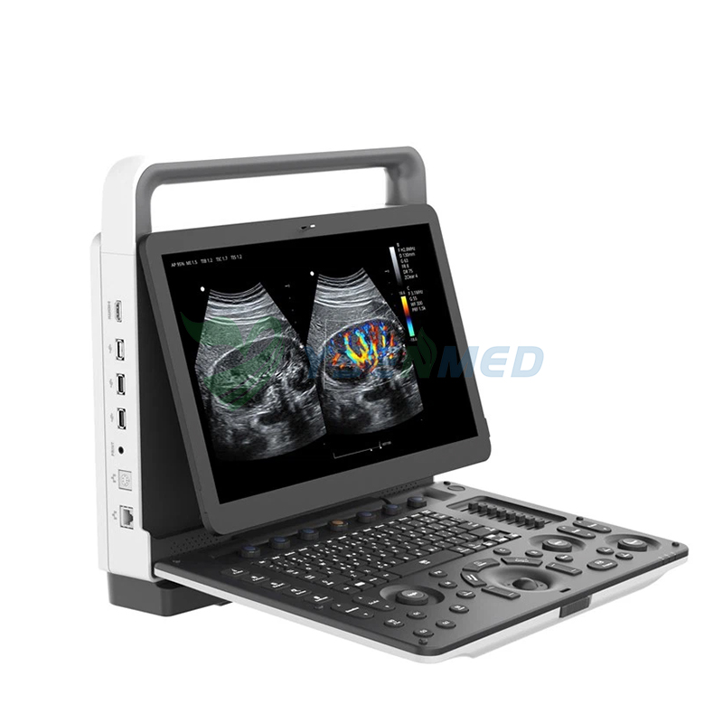 Color Doppler Ultrasound Diagnostic system YSB-M70,Ultrasound