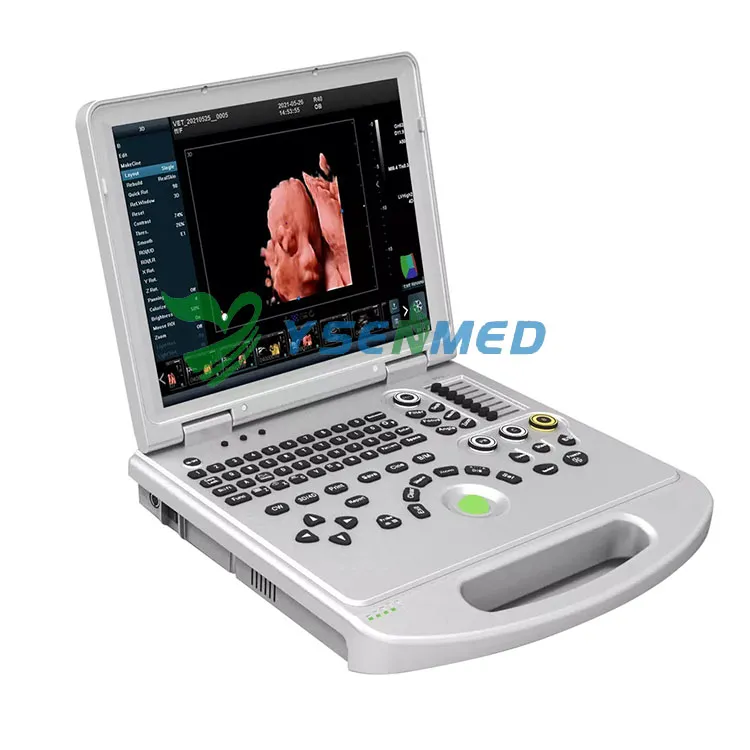 The Economic Benefits of Investing in Portable Color Ultrasound Technology
