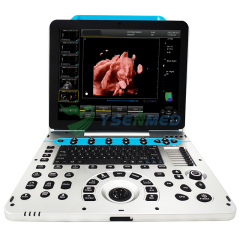 Portable Color Ultrasound System YSB-P30