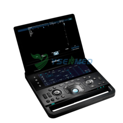 SonoScape X11 Premium Portable Ultrasound System