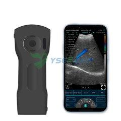 3 in 1 wireless ultrasound probe YSB-C10XS