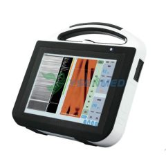 Liver Shear Wave Quantitative Ultrasound Diagnostic System YSB-LS1M