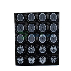 Medical X-ray Dry Thermal Film YSX-JP