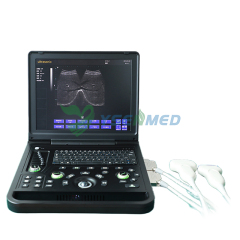 Medical 15'' Laptop BW Ultrasound Machine YSB-SS7C