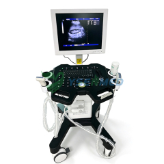 Fully digital ultrasonic diagnostic instrument YSB-750