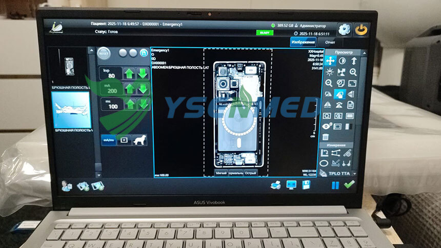 Customer Success Story from Russia | Bulk Order of 5.6kW Mobile X-Ray Machines and Flat Panel Detectors