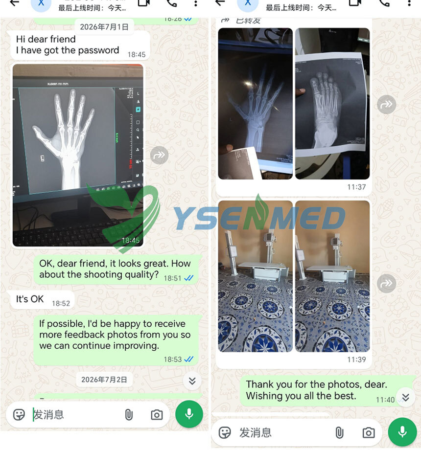 Customer Success Story from Somalia | YSX320D 32kW Digital X-Ray Machine Delivers Good Imaging Results