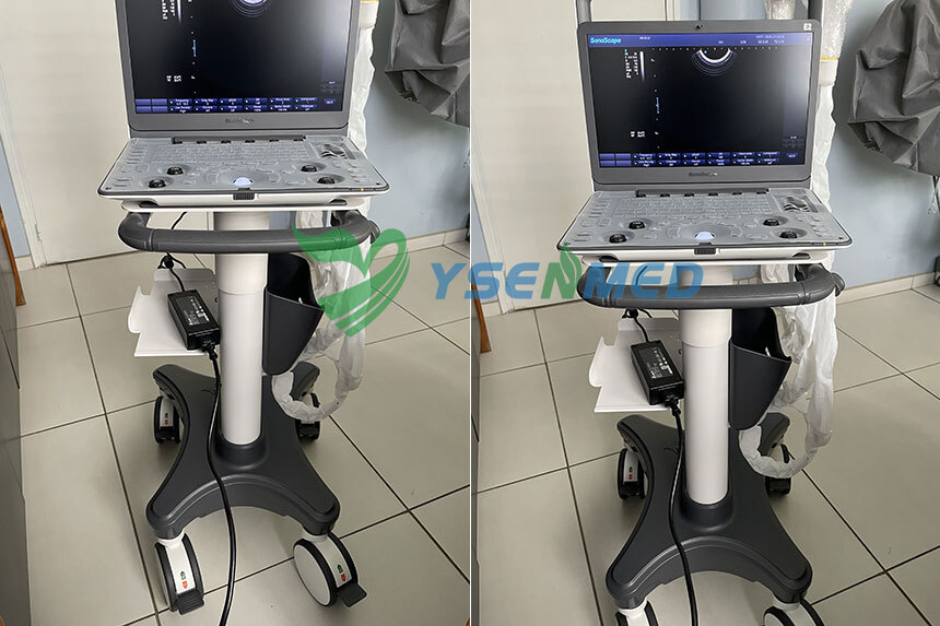 Customer Feedback from France: Good Quality Portable Color Doppler Ultrasound Machine
