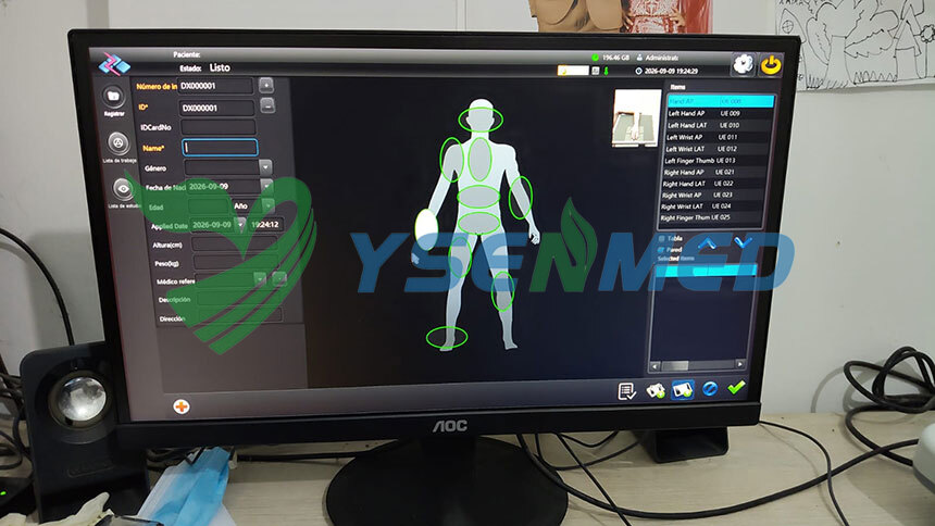 Customer Success Story from Peru: Excellent X-Ray Image Quality After 5 Years of Use