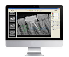 Digital Dental X-ray Sensor YSDEN-500