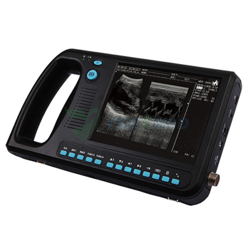 Cheap Price China Handheld Portable Ultrasound Scanner YSB3000