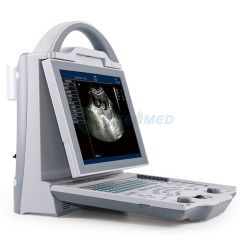 Appareil à ultrasons portable noir et blanc YSB5600