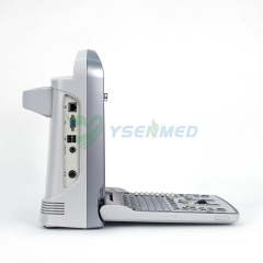Échographe couleur 3d 4d portable CHISON ECO5