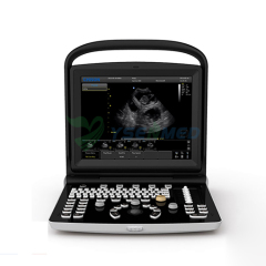 Ecógrafo portátil B/N CHISON ECO1