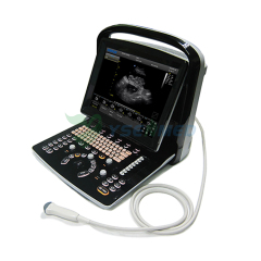 Ecógrafo portátil B/N CHISON ECO3