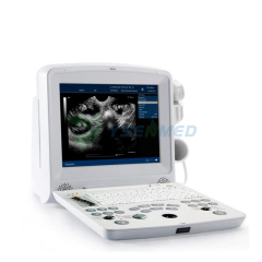 B/W Ultrasound Machine EDAN DUS 60