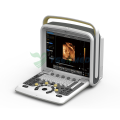 Máquina portátil de ultrasonido Doppler color 4D CHISION Q5