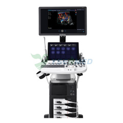 Sonoscape P50 Elite mobile color doppler ultrasound machine