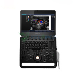 Best Selling Portable Color Doppler Ultrasound Machine SonoScape X5