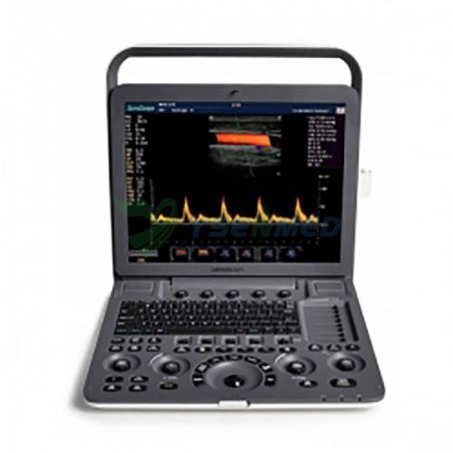Sistema de ultrasonido portátil Doppler color SonoScape S9 PRO