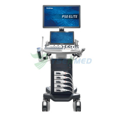 Sonoscape P50 Elite mobile color doppler ultrasound machine