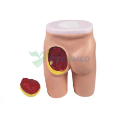 Injection avancée des muscles de la hanche et modèle de structure anatomique YSBIX-H4T