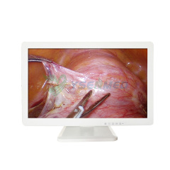 YSENMED 4K Ultra HD Endoscope Camera System YSNJ-TC-4K