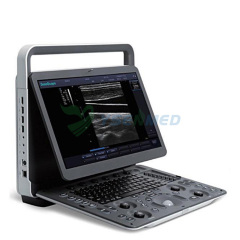 Sonoscape E2 portable colour doppler ultrasound machine