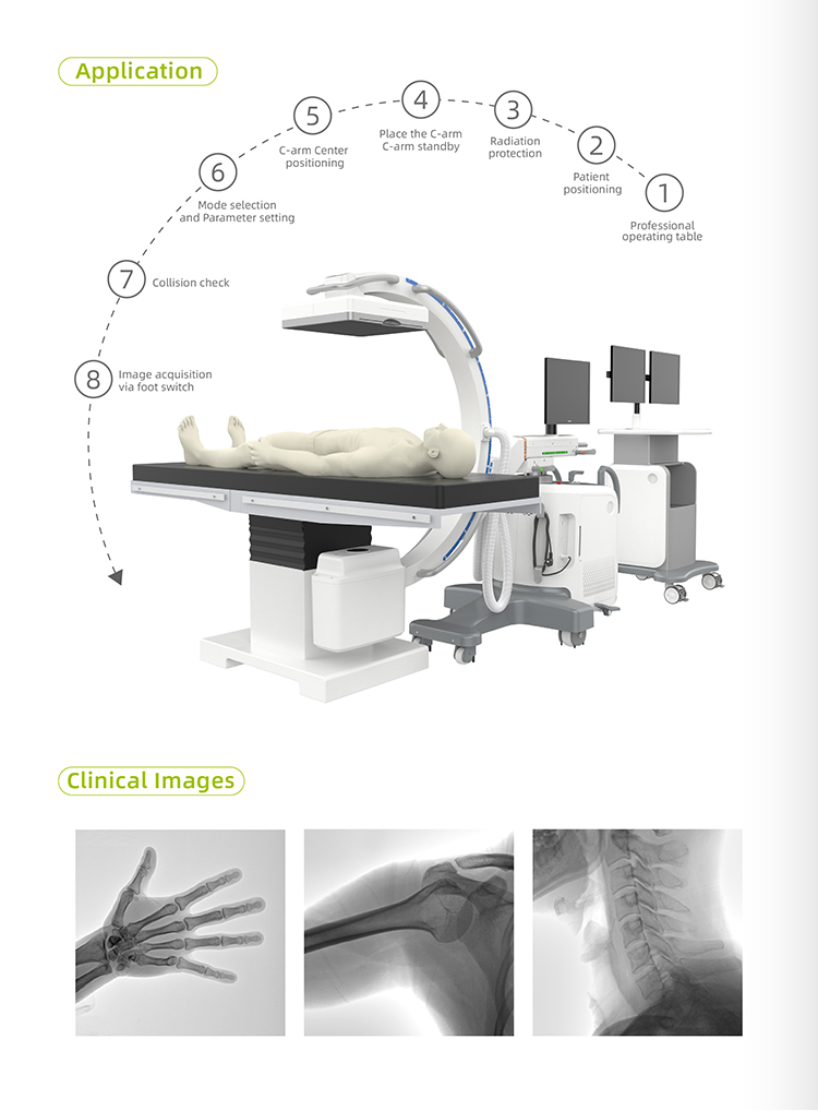 flat panel detector c-arm